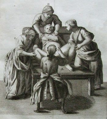 szülés